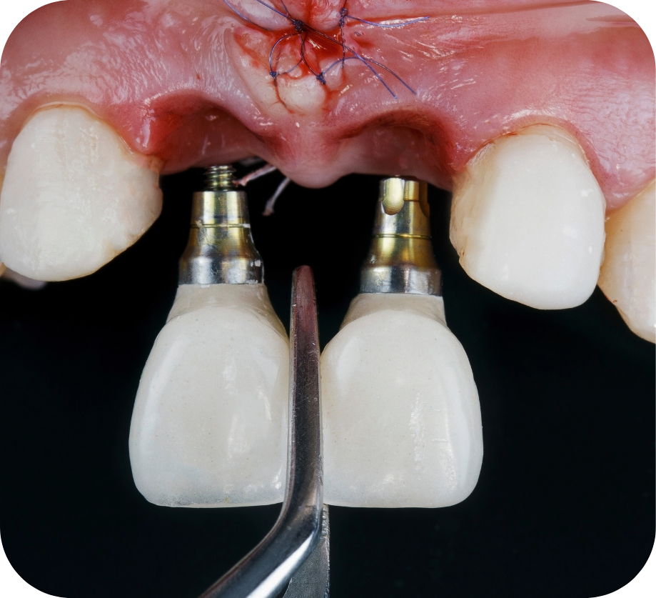 طب الأسنان والوقائي